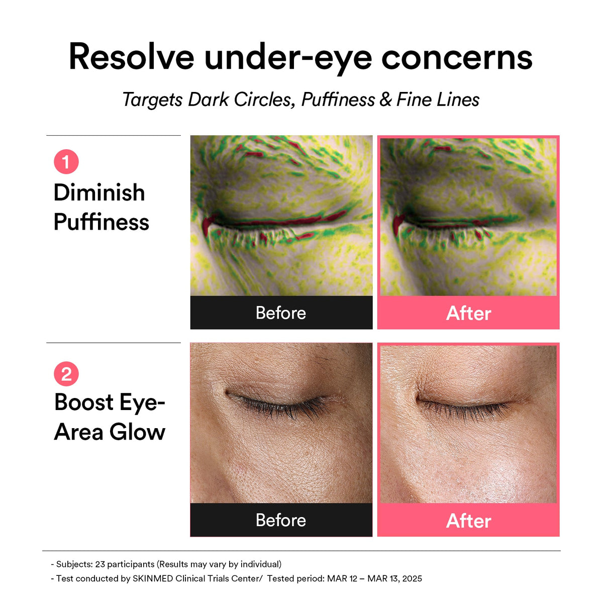 Abib PDRN Retinal Eye Patch Glow Jelly – patches περιποίησης ματιών