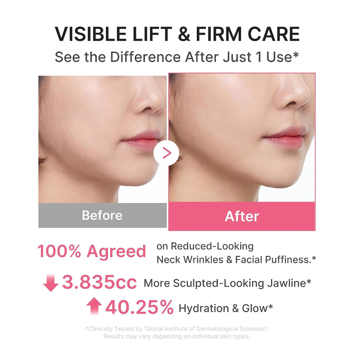 Medicube PDRN Collagen Gua Sha Neck Wrinkle Cream 90g – αποτελέσματα περιποίησης
