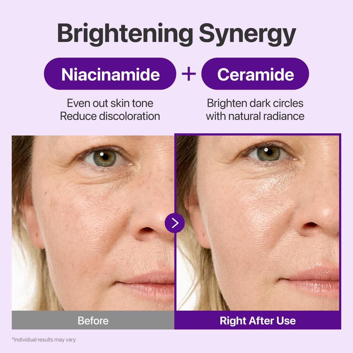 numbuzin No.9 NAD+ Retinal Volumetox Eye Cream 20ml – brightening care