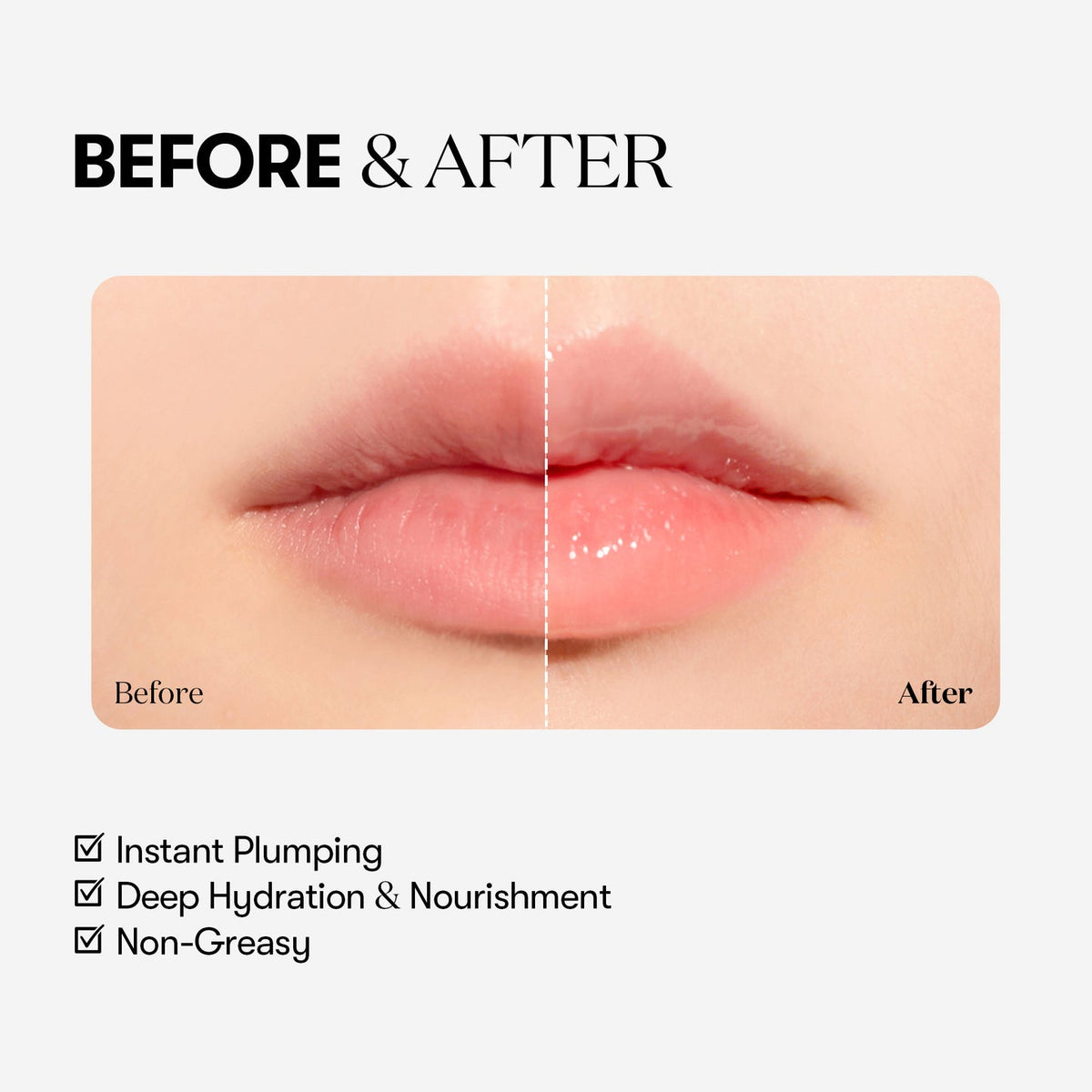 VT Cosmetics Reedle Shot Lip Plumper Beginner – οφέλη