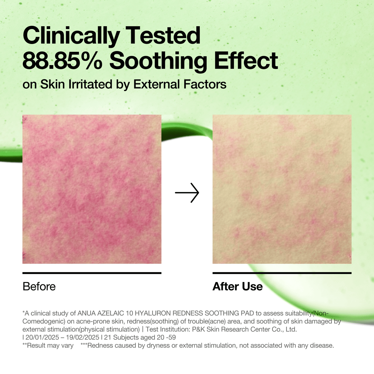 Anua Azelaic 10 Hyaluron Redness Soothing Pad texture and benefits