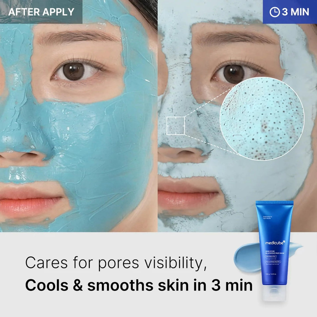 Medicube Zero Pore Blackhead Mud Mask 100g – 3 λεπτά