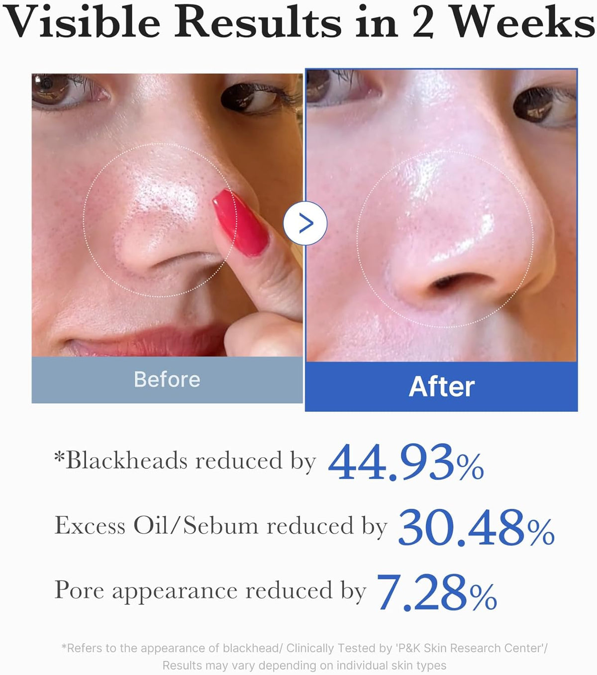 Medicube Zero Pore Pad 2.0 dual textured pads