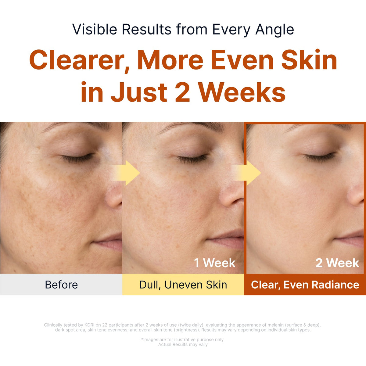 Sungboon Editor Kojic Acid Niacinamide Brightening Ampoule visible results visual