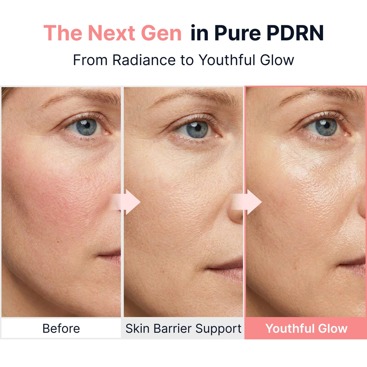 Sungboon Editor Pink PDRN Glow Intensive Ampoule before and after visual